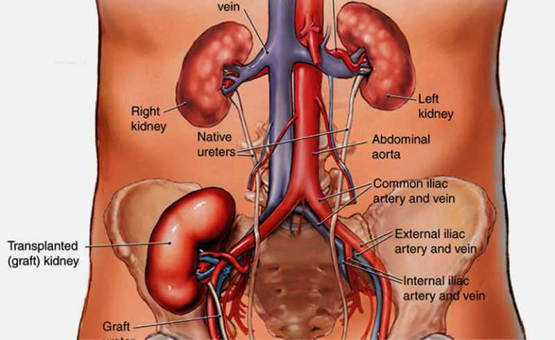 Angka Keberhasilan Transplantasi Ginjal Sangat Tinggi