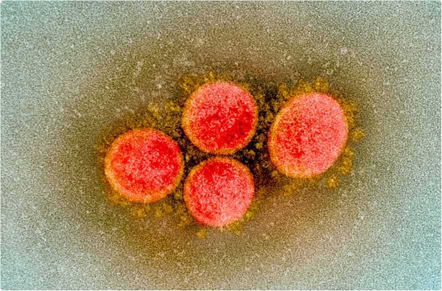 Apakah Varian Virus Korona Baru Lebih Berbahaya?