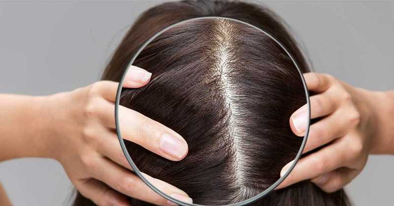 Bamed Hadirkan Layanan Terkait Masalah Rambut dan Kulit Kepala