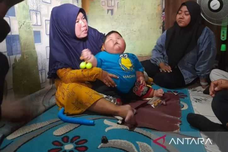 Bayi Obesitas di Bekasi Kenzi Alfaro Dirujuk ke RSCM