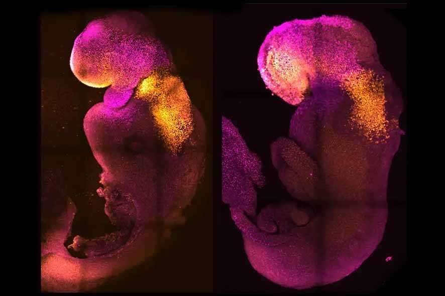 Embrio Sintetis dari Sel Punca Berhasil Membentuk Organ Otak dan Jantung