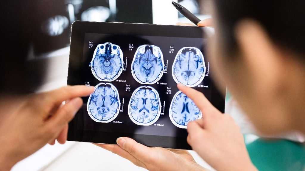 Gawat, Studi Ungkap Mengupil Bisa Meningkatkan Risiko Alzheimer