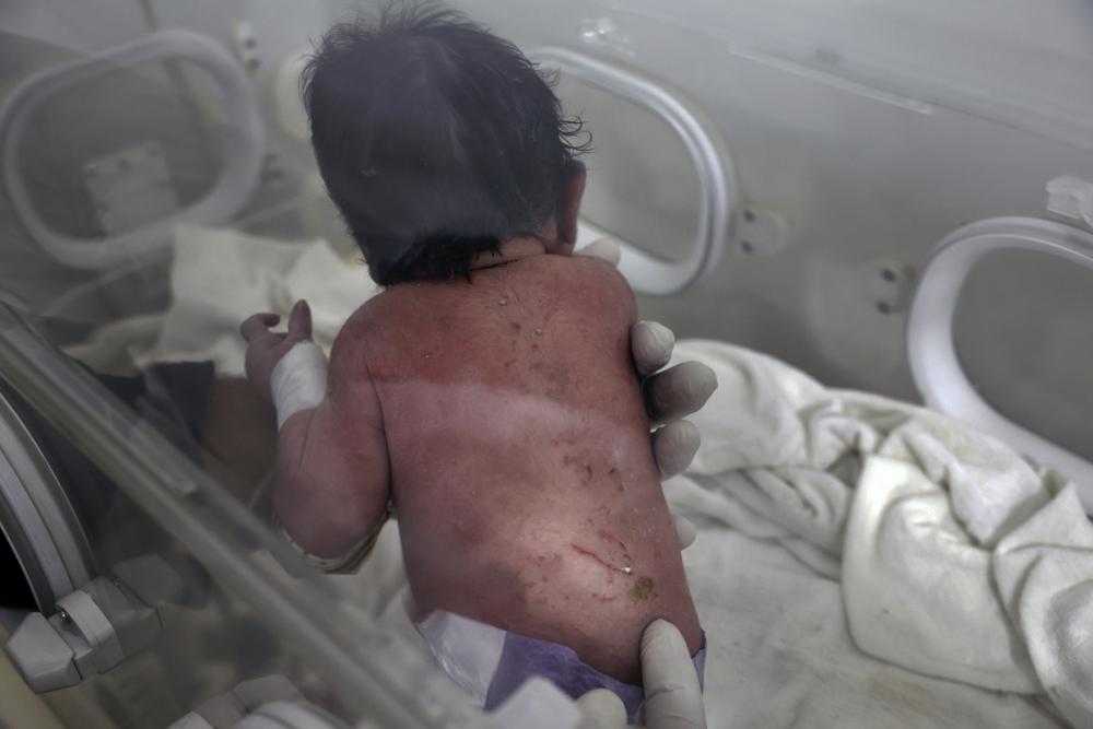 Gempa Turki-Suriah: Seorang Bayi Dilahirkan di Bawah Reruntuhan Gedung