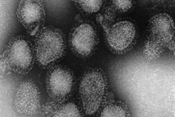 Gempar! Pandemi Covid-19 Memicu Kemunculan Penyakit-penyakit Lama Terhadap Anak, Catat Cara Penanganannya