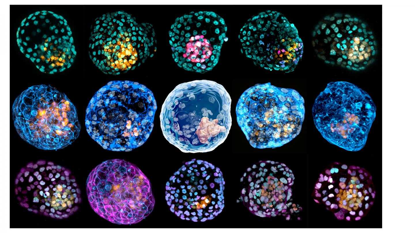 iBlastoid, Terobosan Teknologi Infertilitas