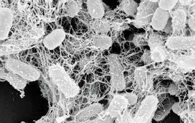Ilmuwan Kembangkan Nano-Nets untuk Membunuh Bakteri yang Kebal Antibiotik