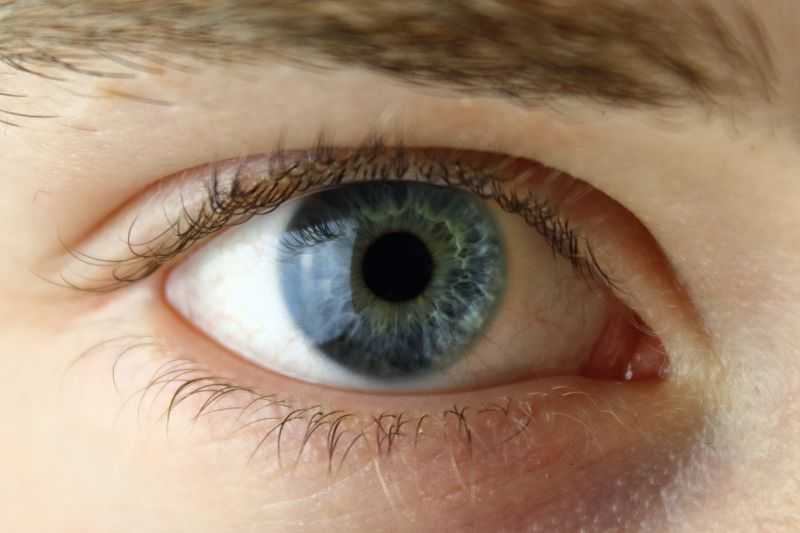 Inilah Cara Efektif Menghilangkan Tonjolan Bawah Mata