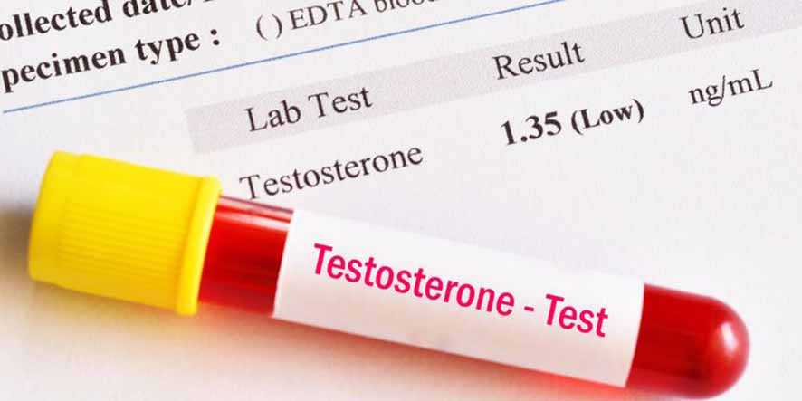 Kadar Testosteron Pengaruhi Tingkat Gejala Covid-19