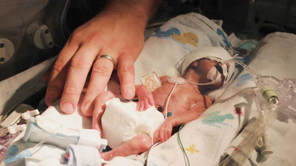 Kelahiran Prematur Sebabkan Tingginya Kasus Kematian Anak