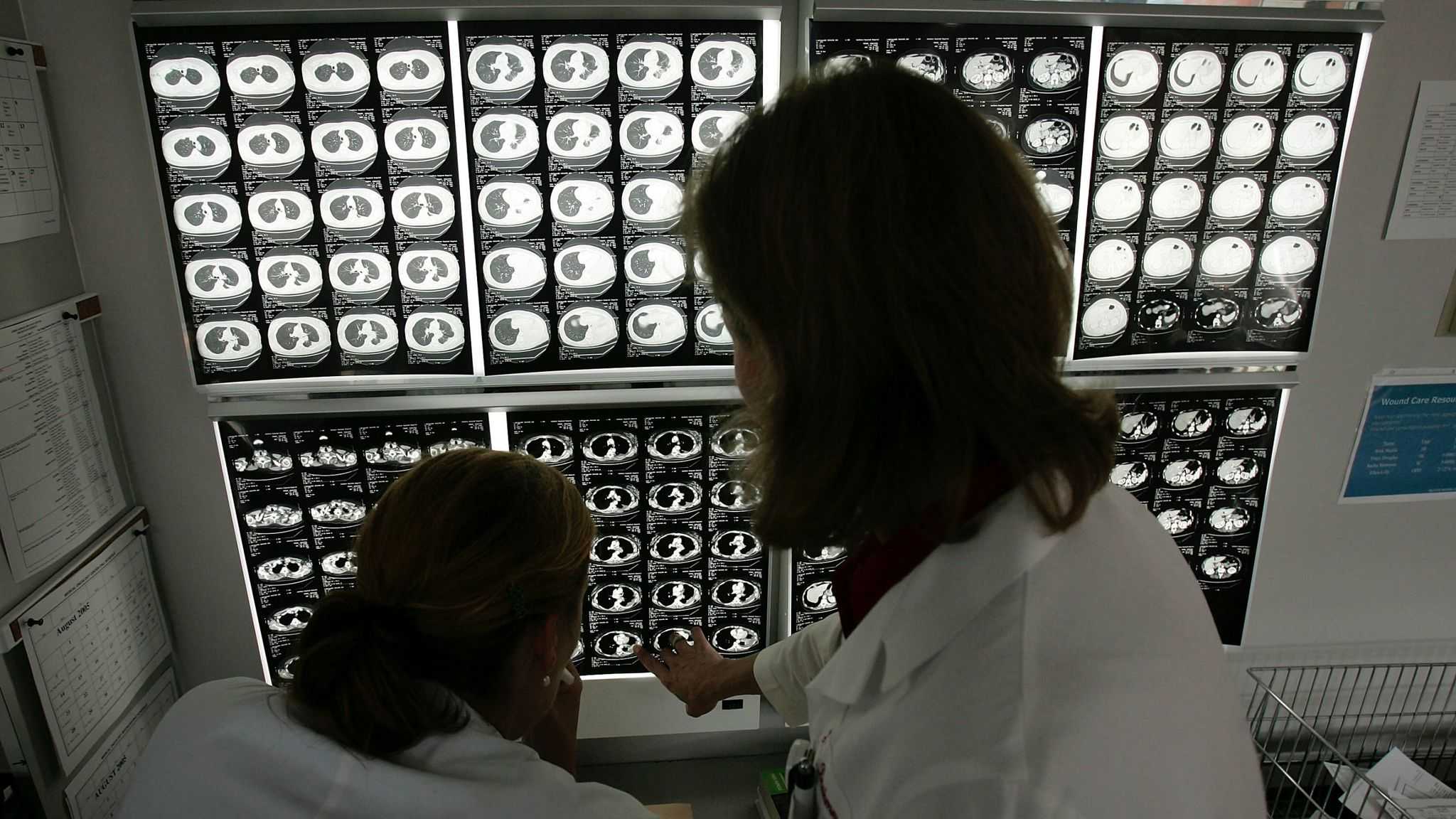 Lembaga Penelitian Kanker: 40 Persen Kasus Kanker dapat Dicegah Sedini Mungkin