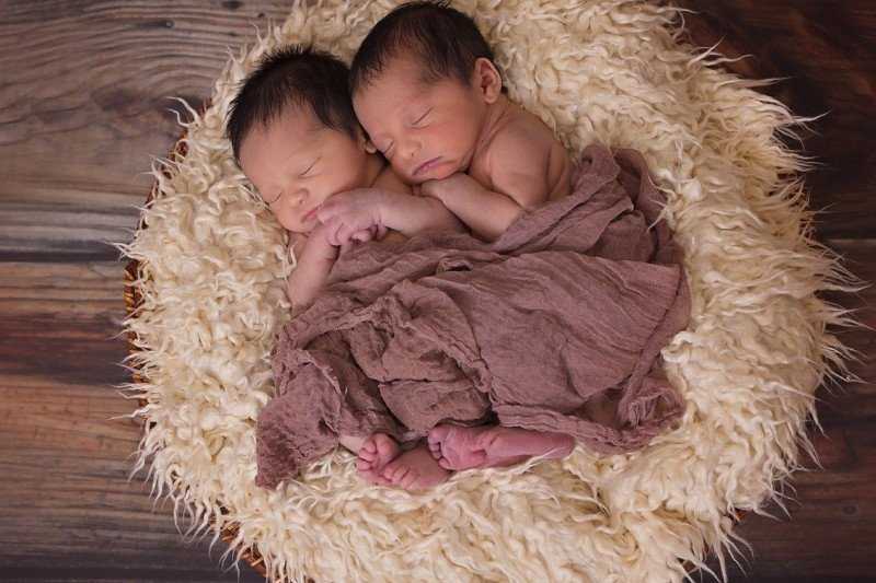 Mengagumkan, Rumah Sakit di Israel Berhasil Pisahkan Kepala Anak Kembar Umur Setahun