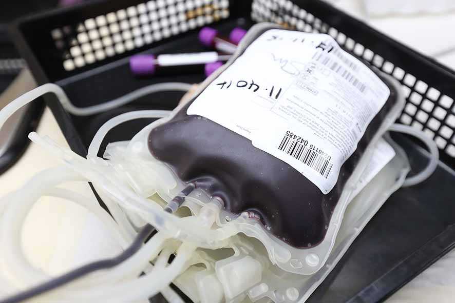 Model Matematis Temukan Pengganti Transfusi Darah