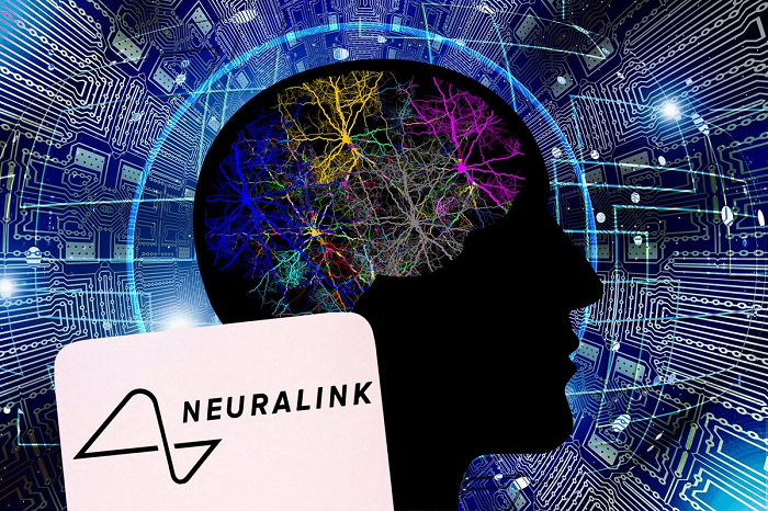 Neuralink Berhasil Menanam Chipnya pada Otak Pasien Kedua