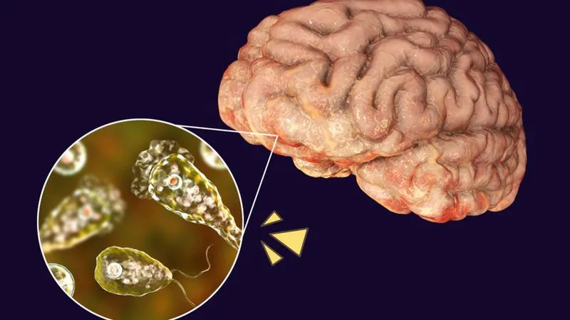 Pakar: Naegleria Fowleri, Amoeba Pemakan Otak yang Harus Diwaspadai