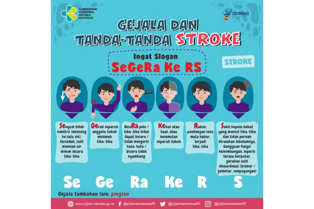 Pakar Neurologi: Kenali Gejala Stroke lewat 'SeGeRa Ke RS'