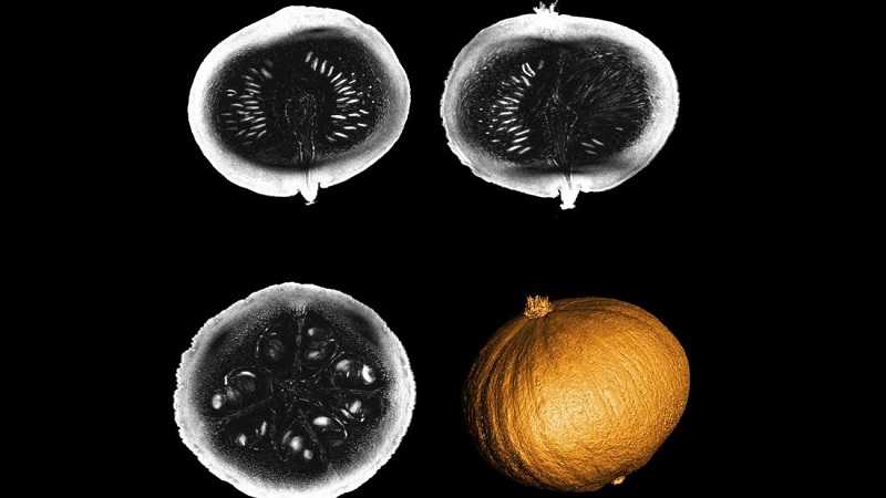 Pemindai MRI Paling Kuat di Dunia Menghasilkan Gambar Pertamanya