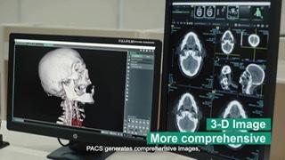 RS PON Gunakan Teknologi FUJIFILM PACS Synapse