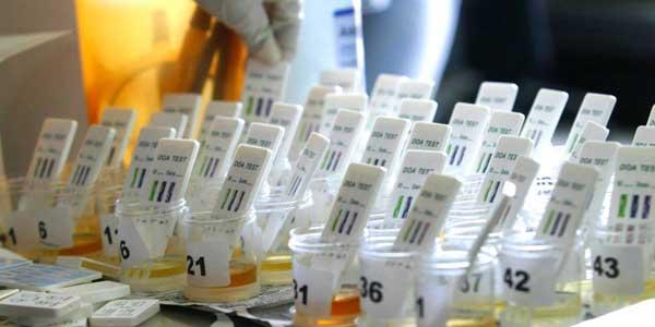Jepang Gunakan Tes Urine untuk Deteksi Kanker