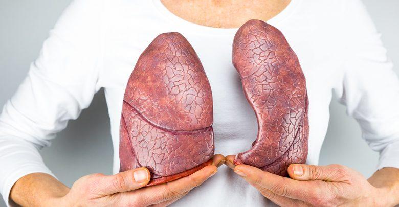 Perokok Pasif Rawan Kanker Paru-paru