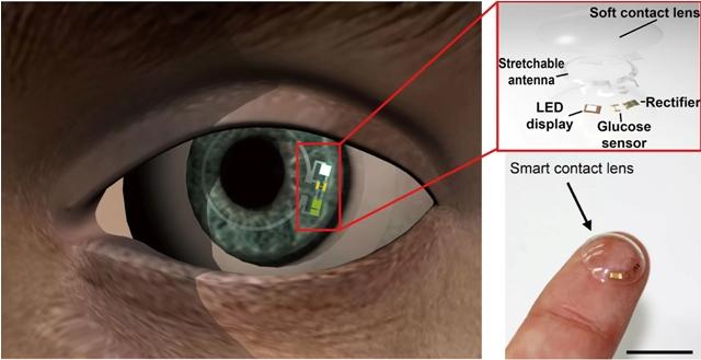 Lensa Pintar Pendeteksi Kadar Glukosa dari Air Mata