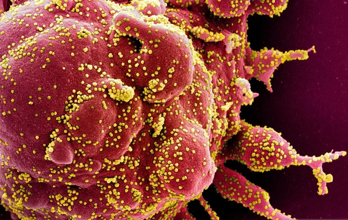 Ilmuwan di Singapura Temukan Varian Baru Virus Korona