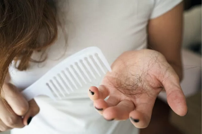 Atasi Rambut Rontok dengan Makanan Mengandung Protein Hingga Biotin