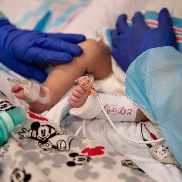 Rawat Inap Anak Melonjak Selama Gelombang Omicron di AS