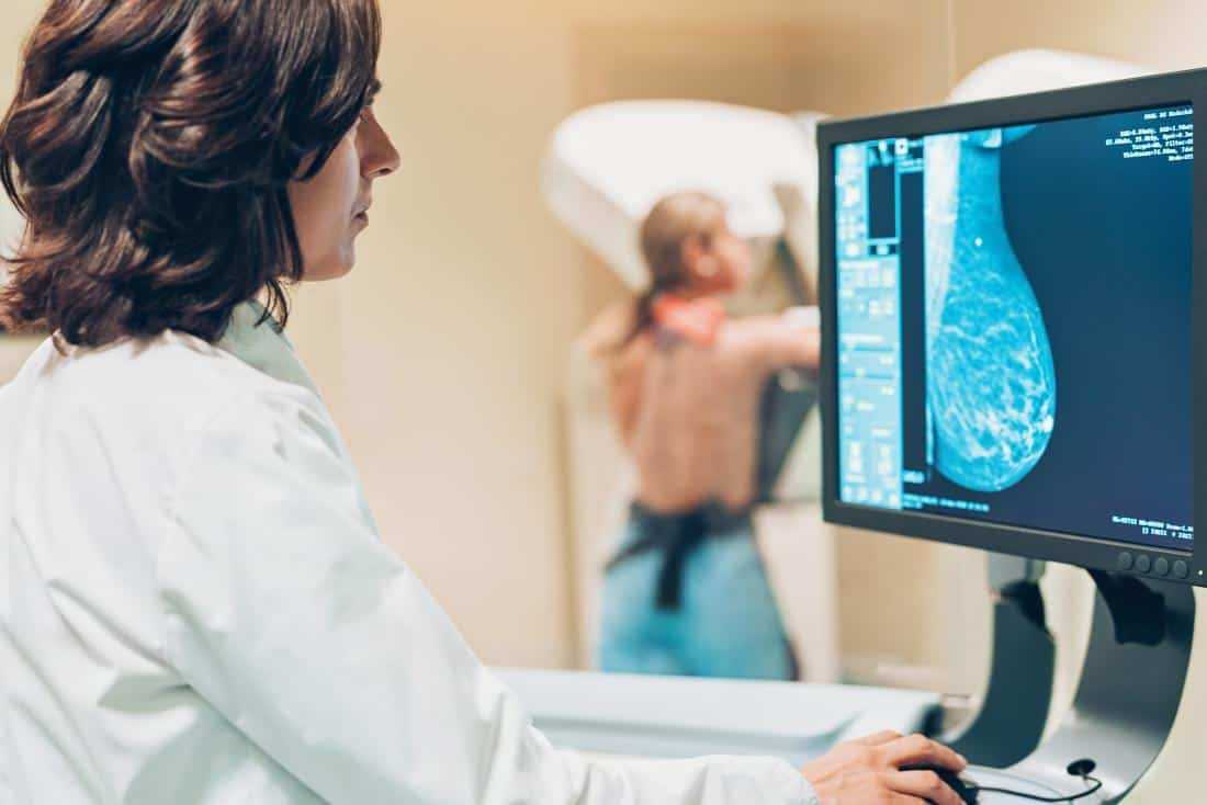 Risiko Kematian Kanker Payudara Tinggi, Indonesia Masih Darurat Mammogram