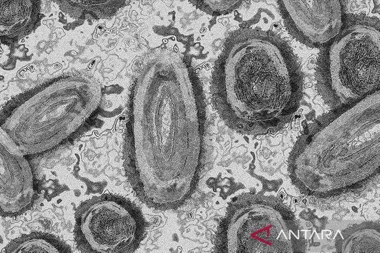 Semoga Tidak Terjadi Lonjakan, AS Tidak Berencana Terapkan Pembatasan Pelancong Afrika Terkait Mpox