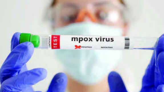 Singapura Mendeteksi 13 Kasus Mpox Clade 2