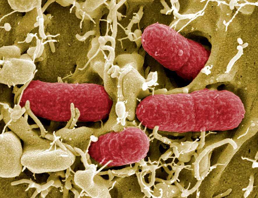 Temuan Polimer Baru yang Dapat Membunuh Bakteri