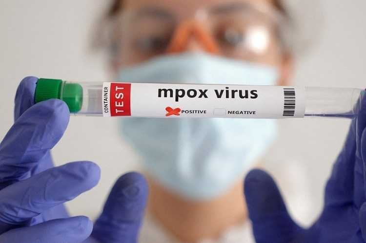 Thailand Melaporkan Kasus Dugaan Strain Mpox Baru