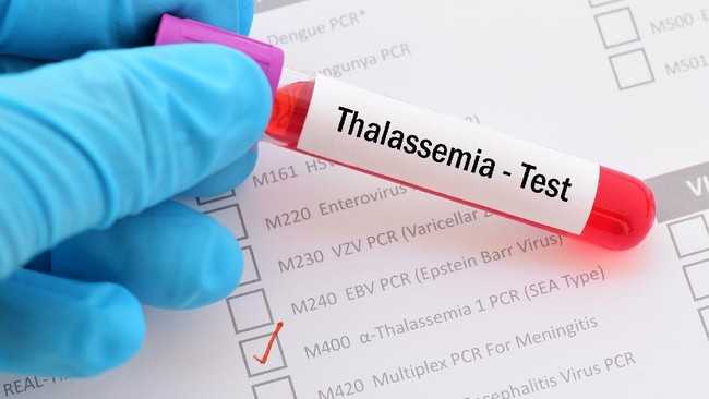 Tidak Semua Talasemia Bergantung pada Transfusi Darah  