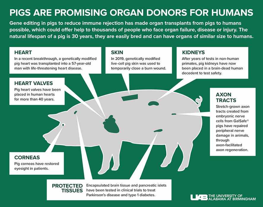 Transplantasi Ginjal Babi ke Manusia