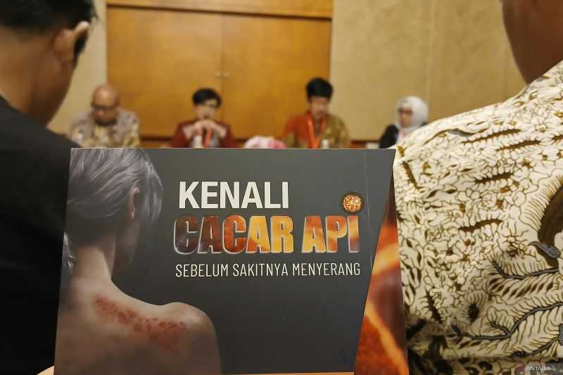 Vaksinasi Cacar Api untuk Warga Usia 18 Tahun ke Atas Guna Cegah Herpes