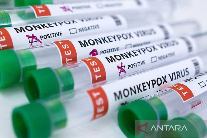 Waduh Makin Mengganas Virus Ini, Varian Baru Cacar Monyet Ditemukan di Inggris